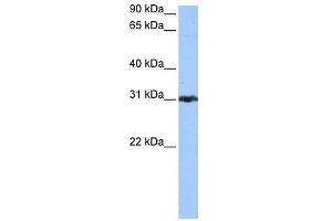 PRDX3 antibody used at 0. (Peroxiredoxin 3 抗体  (N-Term))
