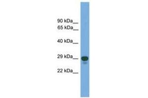 Image no. 1 for anti-Paired Related Homeobox 2 (PRRX2) (AA 71-120) antibody (ABIN6745633) (PRRX2 抗体  (AA 71-120))