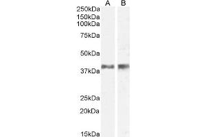 ABIN238549 (0. (IL12B 抗体  (Internal Region))