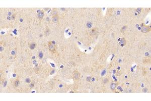 Detection of CAMLG in Human Cerebrum Tissue using Polyclonal Antibody to Calcium Modulating Ligand (CAMLG) (CAMLG 抗体  (AA 19-184))