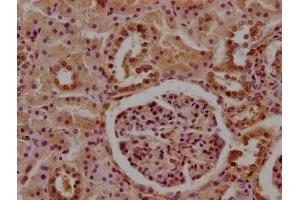 IHC image of ABIN7148399 diluted at 1:100 and staining in paraffin-embedded human kidney tissue performed on a Leica BondTM system. (CFHR5 抗体  (AA 374-569))