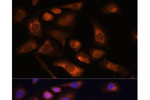 Immunofluorescence analysis of U-2 OS cells using RPS13 Polyclonal Antibody at dilution of 1:100. (RPS13 抗体)