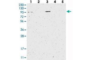 Western blot analysis of Lane 1: RT-4, Lane 2: U-251 MG, Lane 3: Human Plasma, Lane 4: Liver, Lane 5: Tonsil with C17orf28 polyclonal antibody .