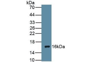 Figure Western Blot Sample: Recombinant DRD1, Rat (Dopamine Receptor d1 抗体  (AA 338-446))