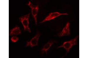 ABIN6267393 staining Hela cells by IF/ICC. (VAV1 抗体  (pTyr174))