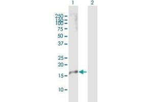 Western Blot analysis of IL23A expression in transfected 293T cell line by IL23A MaxPab polyclonal antibody.