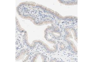Immunohistochemical staining of human gallbladder with MANEA polyclonal antibody  shows moderate cytoplasmic positivity, with a granular pattern, in glandular cells. (MANEA 抗体)