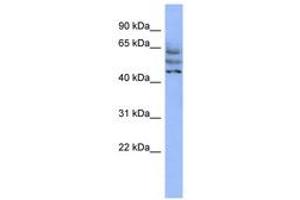 Image no. 1 for anti-Coiled-Coil Domain Containing 174 (CCDC174) (AA 215-264) antibody (ABIN6744101) (CCDC174 抗体  (AA 215-264))