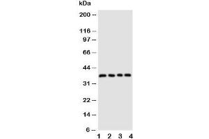 Western blot testing of CD1d antibody and Lane 1:  COLO320;  2: HeLa;  3: HT1080;  4: Jurkat cell lysate (CD1d 抗体  (AA 76-92))