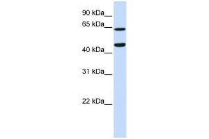 TRIM54 antibody used at 1 ug/ml to detect target protein. (TRIM54 抗体  (N-Term))