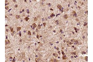 Paraformaldehyde-fixed, paraffin embedded mouse brain, Antigen retrieval by boiling in sodium citrate buffer (pH6) for 15min, Block endogenous peroxidase by 3% hydrogen peroxide for 30 minutes, Blocking buffer (normal goat serum) at 37°C for 20min, Antibody incubation with DCTN3 Polyclonal Antibody at 1:400 overnight at 4°C, followed by a conjugated secondary and DAB staining (DCTN3 抗体  (AA 41-150))