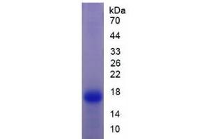 SDS-PAGE analysis of Rat Transthyretin Protein. (TTR 蛋白)
