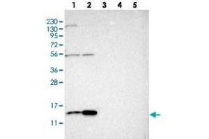 Western blot analysis of Lane 1: RT-4, Lane 2: U-251 MG, Lane 3: Human Plasma, Lane 4: Liver, Lane 5: Tonsil with SLIRP polyclonal antibody  at 1:250-1:500 dilution. (SLIRP 抗体)