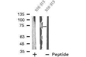 Western blot analysis of ABCG5 using NIH-3T3 whole cell lysates (ABCG5 抗体  (Internal Region))