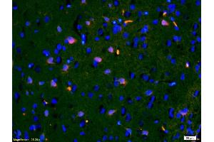 Formalin-fixed and paraffin-embedded rat brain labeled with Anti-IGFBP3 Polyclonal Antibody, Unconjugated (ABIN686497) 1:200, overnight at 4°C, The secondary antibody was Goat Anti-Rabbit IgG,Cy3 conjugated used at 1:200 dilution for 40 minutes at 37°C. (IGFBP3 抗体  (AA 186-292))