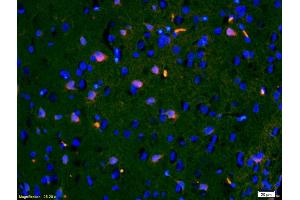 Formalin-fixed and paraffin-embedded rat brain labeled with Anti-IGFBP3 Polyclonal Antibody, Unconjugated (ABIN686497) 1:200, overnight at 4°C, The secondary antibody was Goat Anti-Rabbit IgG,Cy3 conjugated used at 1:200 dilution for 40 minutes at 37°C. (IGFBP3 抗体  (AA 186-292))