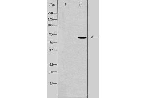 Western blot analysis of extracts from HepG2 cells using DDX52 antibody. (DDX52 抗体  (C-Term))