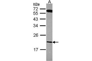 AP31125PU-N RGS10 antibody staining of A431 (Lane A) whole cell lysate (30 µg) at 1/1000 dilution, 12% SDS PAGE. (RGS10 抗体  (AA 1-160))