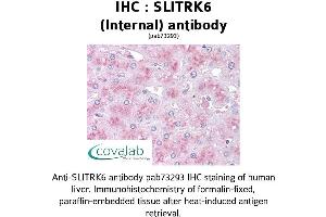 Image no. 1 for anti-SLIT and NTRK-Like Family, Member 6 (SLITRK6) (Internal Region) antibody (ABIN1739441) (SLITRK6 抗体  (Internal Region))