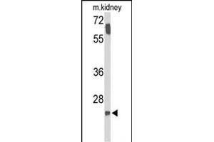 Western blot analysis of SMNDC1 Antibody (N-term) (ABIN653319 and ABIN2842811) in mouse kidney tissue lysates (35 μg/lane). (SMNDC1 抗体  (N-Term))