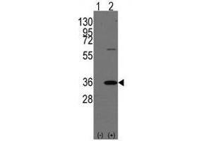 Western blot analysis of PHB2 (arrow) using rabbit polyclonal PHB2 Antibody (Human C-term) . (Prohibitin 2 抗体  (N-Term))