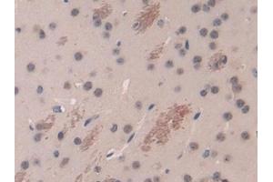 Detection of DARC in Mouse Cerebrum Tissue using Polyclonal Antibody to Duffy Blood Group Chemokine Receptor (DARC) (DARC 抗体  (AA 71-330))