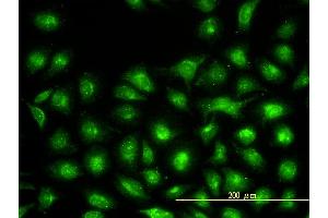 Immunofluorescence of monoclonal antibody to UBE2L3 on HeLa cell. (UBE2L3 抗体  (AA 1-154))