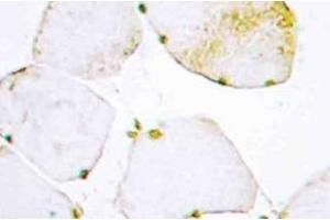 Immunohistochemistry (IHC) analyzes of UDG antibody in paraffin-embedded human skeletal muscle tissue. (Cyclin O 抗体)