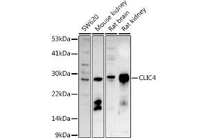 Western blot analysis of extracts of various cell lines, using CLIC4 antibody (ABIN6127638, ABIN6138723, ABIN6138724 and ABIN6222890) at 1:500 dilution. (CLIC4 抗体  (AA 1-253))