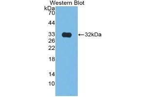 Detection of Recombinant CS, Rat using Polyclonal Antibody to Citrate Synthase (CS) (CS 抗体  (AA 56-312))