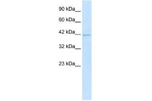 WB Suggested Anti-HOXA10 Antibody Titration:  1. (HOXA10 抗体  (N-Term))