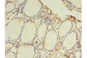 Immunohistochemistry of paraffin-embedded human thyroid tissue using ABIN7172278 at dilution of 1:100