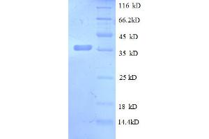 SDS-PAGE (SDS) image for Chemokine (C-X-C Motif) Ligand 13 (CXCL13) (AA 23-108) protein (GST tag) (ABIN5712552) (CXCL13 Protein (AA 23-108) (GST tag))