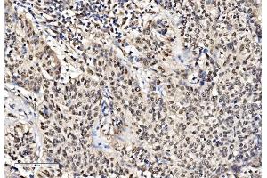 IHC analysis of KHSRP using anti-KHSRP antibody (ABIN7599776).