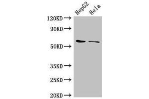 Western Blot Positive WB detected in: HepG2 whole cell lysate, Hela whole cell lysate All lanes: CDT1 antibody at 3 μg/mL Secondary Goat polyclonal to rabbit IgG at 1/50000 dilution Predicted band size: 61 kDa Observed band size: 61 kDa (CDT1 抗体  (AA 12-170))