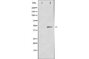 Western blot analysis of GATA4 expression in Serum treated COLO205 whole cell lysates,The lane on the left is treated with the antigen-specific peptide. (GATA4 抗体  (Internal Region))