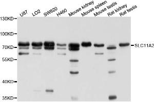 Western blot analysis of extracts of various cell lines, using SLC11A2 antibody (ABIN4905173) at 1:1000 dilution. (SLC11A2 抗体)