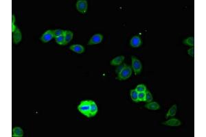 Immunofluorescent analysis of HepG2 cells using ABIN7156651 at dilution of 1:100 and Alexa Fluor 488-congugated AffiniPure Goat Anti-Rabbit IgG(H+L) (IFIH1 抗体  (AA 700-1025))