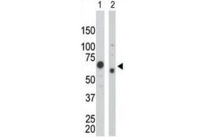 Western Blotting (WB) image for anti-Pyruvate Kinase (PK) antibody (ABIN2995247) (Pyruvate Kinase 抗体)