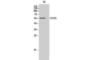 Western Blotting (WB) image for anti-Cytochrome P450, Family 2, Subfamily E, Polypeptide 1 (CYP2E1) (C-Term) antibody (ABIN3184187)