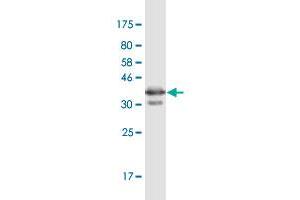 Western Blot detection against Immunogen (36. (PGRMC1 抗体  (AA 96-195))