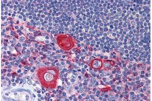 Human Thymus: Formalin-Fixed, Paraffin-Embedded (FFPE) (SNAPIN 抗体  (AA 41-137))