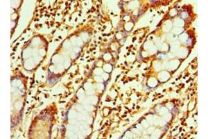 Immunohistochemistry of paraffin-embedded human small intestine tissue using ABIN7167347 at dilution of 1:100 (Rab4 抗体  (AA 1-218))