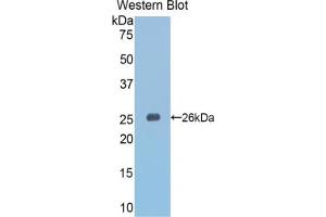Western blot analysis of the recombinant protein. (SLIT3 抗体  (AA 1348-1517))