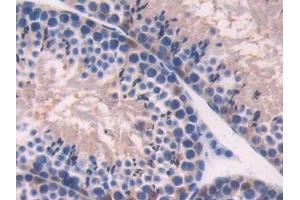 Detection of ADK in Mouse Testis Tissue using Polyclonal Antibody to Adenosine Kinase (ADK) (ADK 抗体  (AA 1-361))