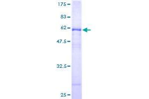 Image no. 1 for Carbonic Anhydrase IV (CA4) (AA 19-312) protein (GST tag) (ABIN1347771)