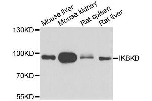 Western blot analysis of extracts of various cell lines, using IKBKB antibody. (IKBKB 抗体  (AA 517-756))