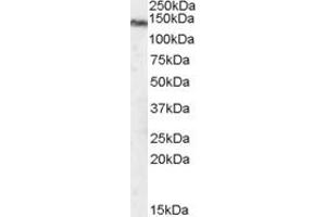 Western Blotting (WB) image for anti-Transient Receptor Potential Cation Channel, Subfamily M, Member 7 (TRPM7) (C-Term) antibody (ABIN184611)