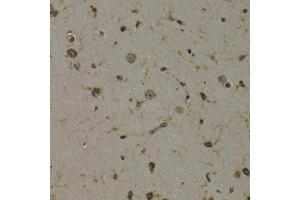 Immunohistochemistry (IHC) image for anti-Eukaryotic Translation Elongation Factor 1 delta (Guanine Nucleotide Exchange Protein) (EEF1D) (AA 1-160) antibody (ABIN3023319)