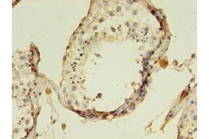 Immunohistochemistry of paraffin-embedded human testis tissue using ABIN7157768 at dilution of 1:100 (AADAT 抗体  (AA 30-425))